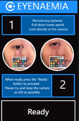 Eyenaemia ������������� ������ �� �����