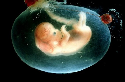 ���������� ������ ����� �������������� ���� �������� ��������