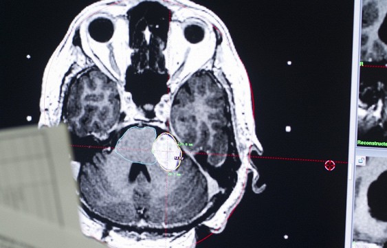 
������������� ������ �������� ��� ��������� ���������������
