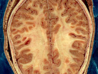 ���������� �������� ������� �� ������� �����