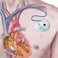 ����� ����������������� ����� �������� � ������